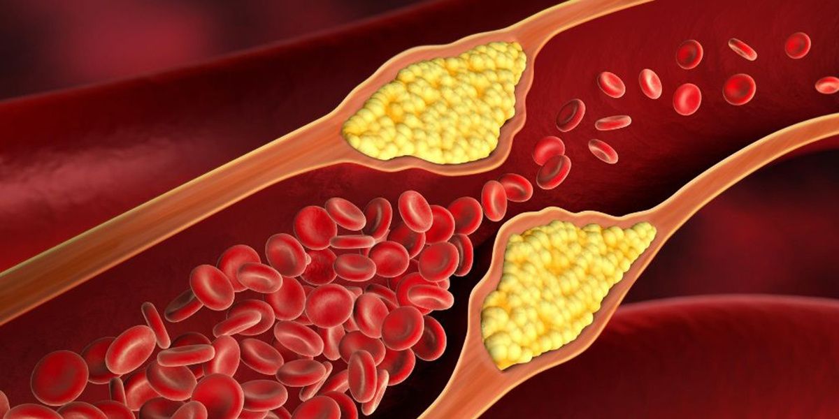 Как есть мясо и заботиться о сердце: секреты правильного холестерина