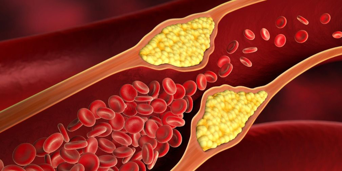 Как есть мясо и заботиться о сердце: секреты правильного холестерина